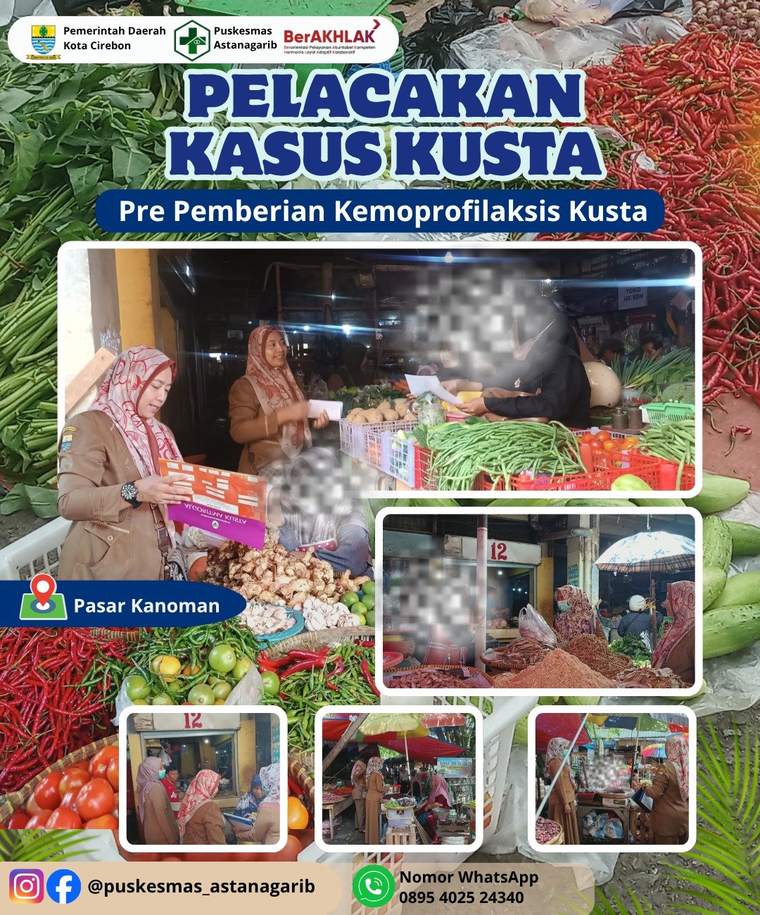 Pelacakan Kasus Kusta
